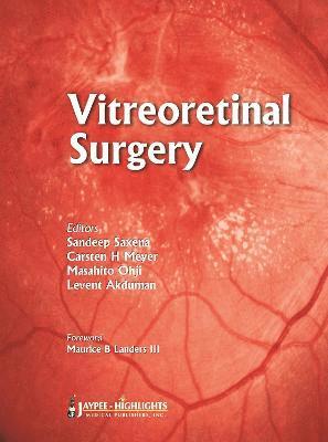 bokomslag Vitreoretinal  Surgery