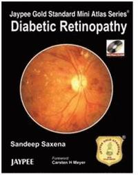 bokomslag Jaypee Gold Standard Mini Atlas Series: Diabetic Retinopathy