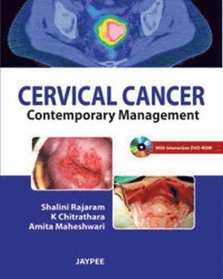 bokomslag Cervical Cancer