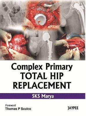 SKS Marya - Complex Primary Total Hip Replacement, Inbunden