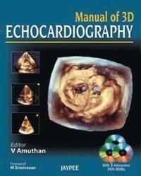 bokomslag Manual of 3D Echocardiography