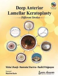 bokomslag Deep Anterior Lamellar Keratoplasty Different Strokes
