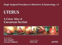 bokomslag Single Surgical Procedures in Obstetrics and Gynaecology - Volume 14 - Uterus
