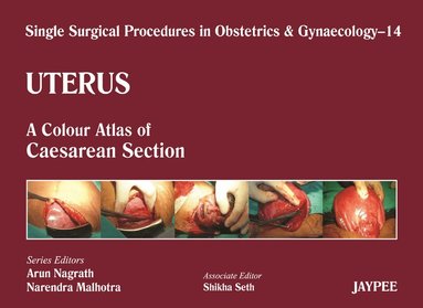 Arun Nagrath, Narendra Malhotra, Shikha Seth - Single Surgical Procedures in Obstetrics and Gynaecology - Volume 14 - Uterus, Inbunden