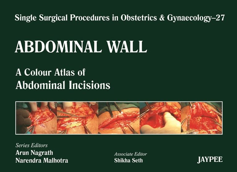 Single Surgical Procedures in Obstetrics and Gynaecology - Volume 27 - Abdominal Wall 1