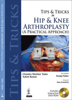 bokomslag Tips and Tricks in Hip and Knee Arthroplasty