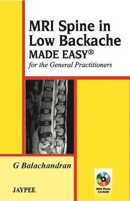 MRI Spine in Low Backache Made Easy 1