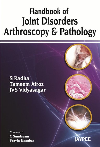 S Radha, Tameem Afroz, JVS Vidyasagar - Handbook of Joint Disorders Arthroscopy & Pathology, Häftad