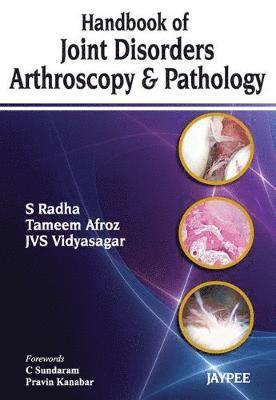 Handbook of Joint Disorders Arthroscopy & Pathology 1