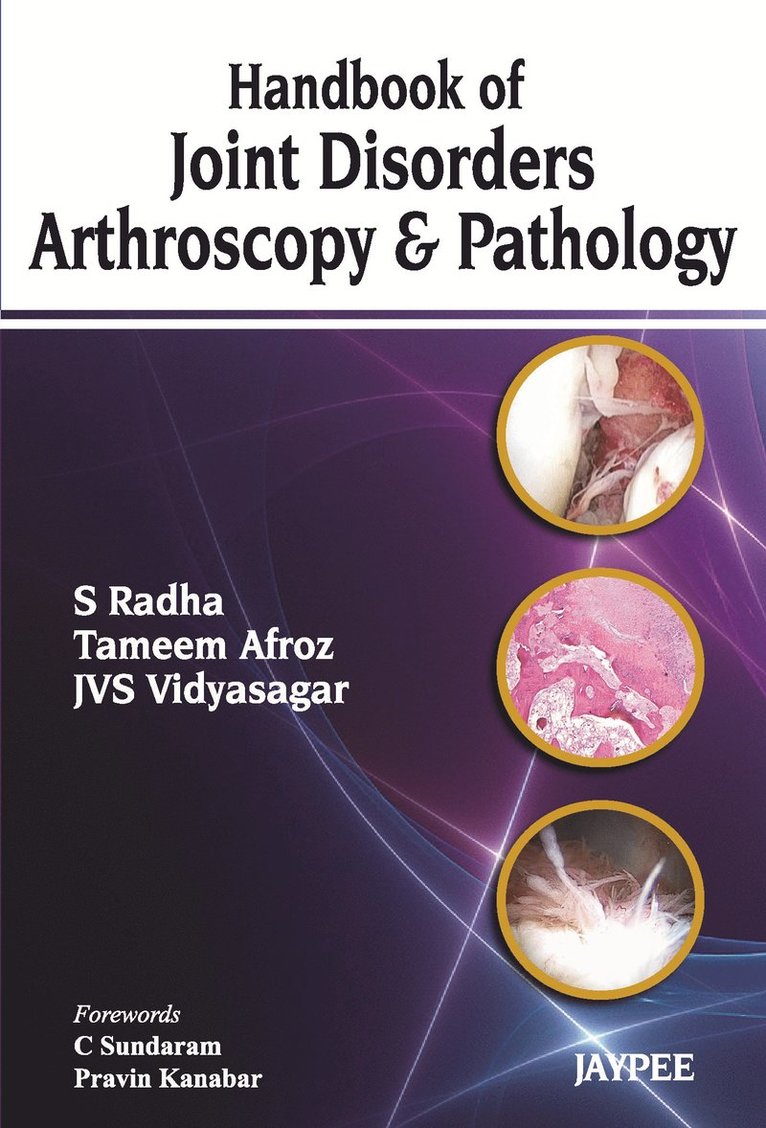 S Radha, Tameem Afroz, JVS Vidyasagar - Handbook of Joint Disorders Arthroscopy & Pathology, Häftad