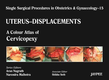 Arun Nagrath, Narendra Malhotra, Shikha Seth - Single Surgical Procedures in Obstetrics and Gynaecology - Volume 15 - UTERUS - DISPLACEMENTS, Inbunden