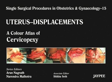 bokomslag Single Surgical Procedures in Obstetrics and Gynaecology - Volume 15 - UTERUS - DISPLACEMENTS