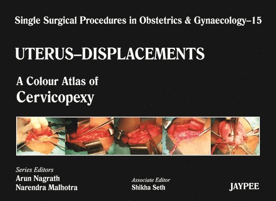 Single Surgical Procedures in Obstetrics and Gynaecology - Volume 15 - UTERUS - DISPLACEMENTS 1