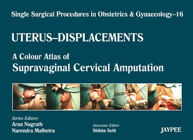 Arun Nagrath, Narendra Malhotra, Shikha Seth - Single Surgical Procedures in Obstetrics and Gynaecology - Volume 16 - UTERUS - DISPLACEMENTS, Inbunden