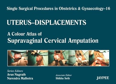 bokomslag Single Surgical Procedures in Obstetrics and Gynaecology - Volume 16 - UTERUS - DISPLACEMENTS
