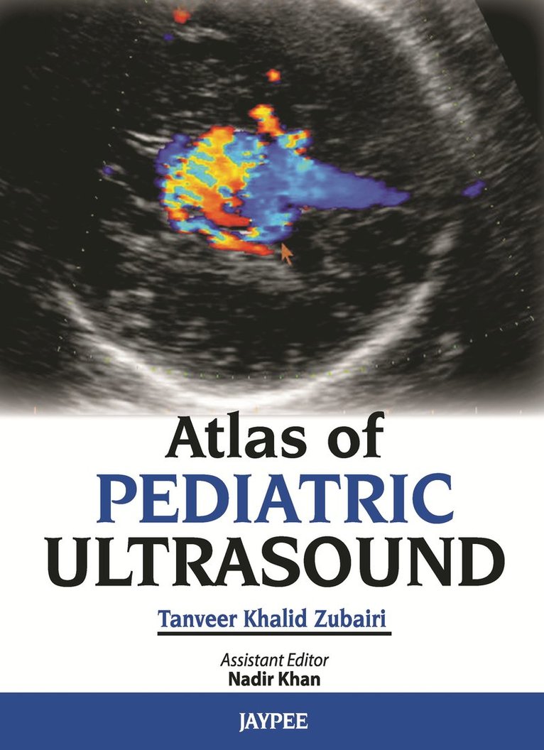 Tanveer Khalid Zubairi, Nadir Khan - Atlas of Pediatric Ultrasound, Inbunden