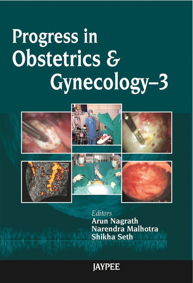 Arun Nagrath, Narendra Malhotra, Seth Shikha - Progress in Obstetrics & Gynecology, Häftad