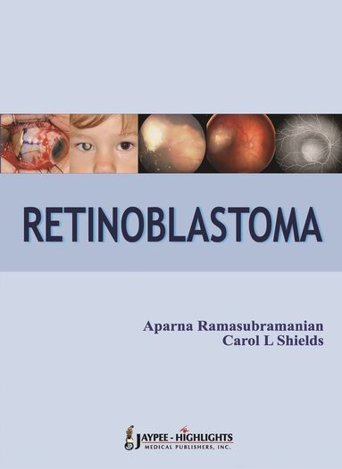 bokomslag Retinoblastoma