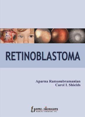 Retinoblastoma 1