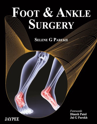 Selene Parekh - Foot and Ankle Surgery, Inbunden