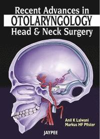 bokomslag Recent Advances in Otolaryngology - Head and Neck Surgery