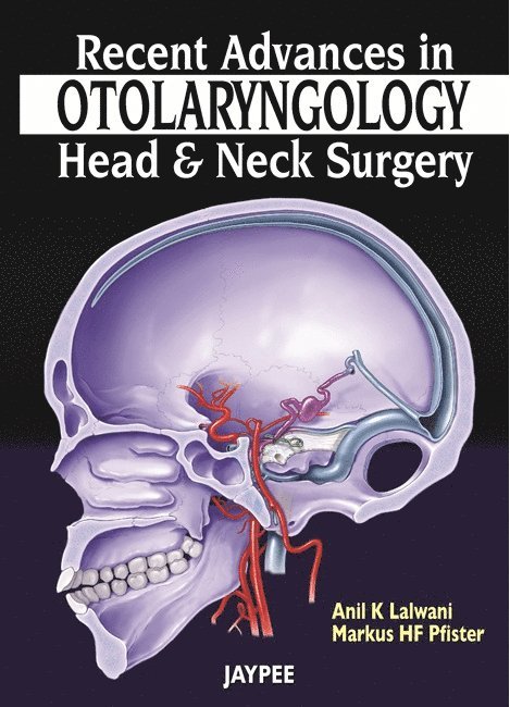Anil K Lalwani, Markus H F Pfister - Recent Advances in Otolaryngology - Head and Neck Surgery, Häftad