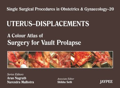 Arun Nagrath, Narendra Malhotra, Shikha Seth - Single Surgical Procedures in Obstetrics and Gynaecology - Volume 20 - UTERUS - DISPLACEMENTS, Inbunden