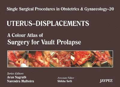 Single Surgical Procedures in Obstetrics and Gynaecology - Volume 20 - UTERUS - DISPLACEMENTS 1