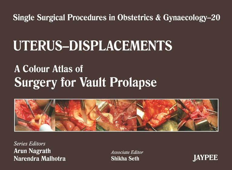 Arun Nagrath, Narendra Malhotra, Shikha Seth - Single Surgical Procedures in Obstetrics and Gynaecology - Volume 20 - UTERUS - DISPLACEMENTS, Inbunden