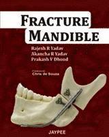 bokomslag Fracture Mandible