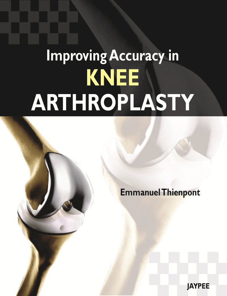 Improving Accuracy in Knee Arthroplasty 1