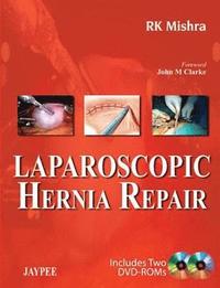 bokomslag Laparoscopic Hernia Repair
