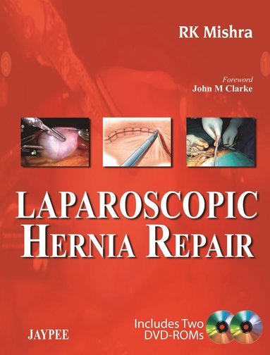 bokomslag Laparoscopic Hernia Repair