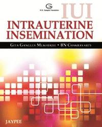 bokomslag IUI Intrauterine Insemination