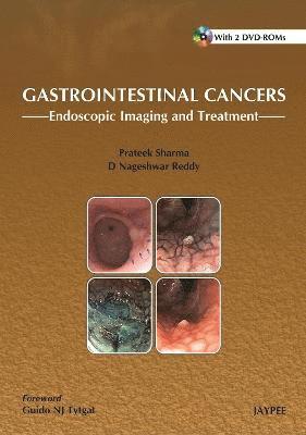 bokomslag Gastrointestinal Cancers: