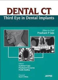 bokomslag Dental CT Third Eye in Dental Implants