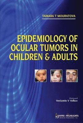 bokomslag Epidemiology of Ocular Tumors in Children & Adults