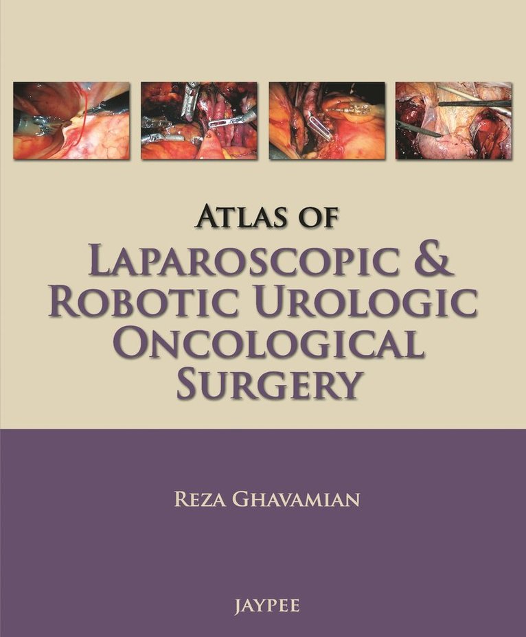 Reza Ghavamian - Atlas of Laparoscopic and Robotic Urologic Oncological Surgery, Häftad