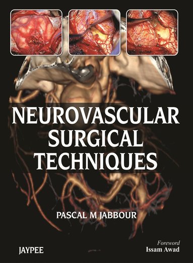 bokomslag Neurovascular Surgical Techniques