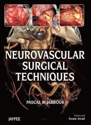 Neurovascular Surgical Techniques 1