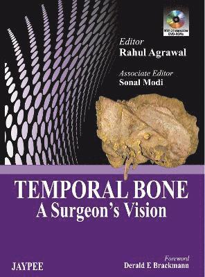 Temporal Bone 1