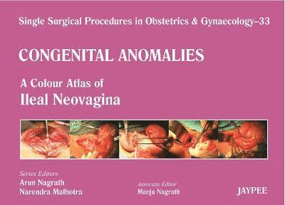 Single Surgical Procedures in Obstetrics and Gynaecology - 33 - Congenital Anomalies: A Colour Atlas of Ileal Neovagina 1