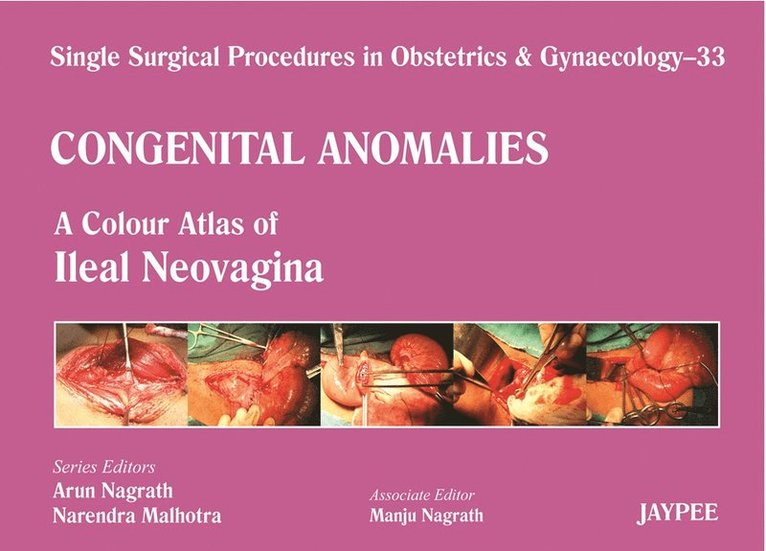 Arun Nagrath, Narendra Malhotra, Manju Nagrath - Single Surgical Procedures in Obstetrics and Gynaecology - 33 - Congenital Anomalies: A Colour Atlas of Ileal Neovagina, Inbunden