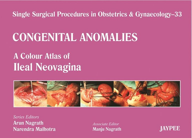 Single Surgical Procedures in Obstetrics and Gynaecology - 33 - Congenital Anomalies: A Colour Atlas of Ileal Neovagina 1