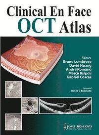 bokomslag Clinical En Face OCT Atlas
