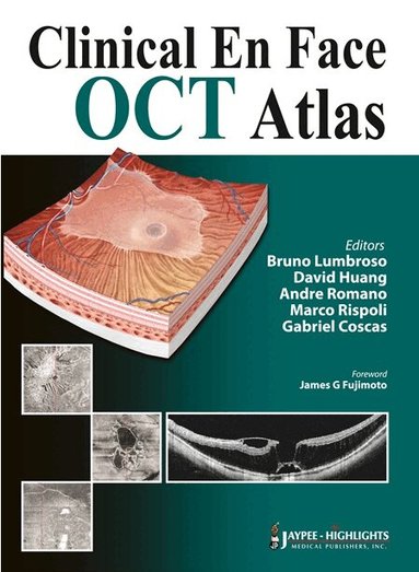 Bruno Lumbroso, David Huang, Andre Romano, Marco Rispoli, Gabriel Coscas - Clinical En Face OCT Atlas, Inbunden