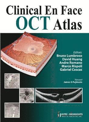 Clinical En Face OCT Atlas 1