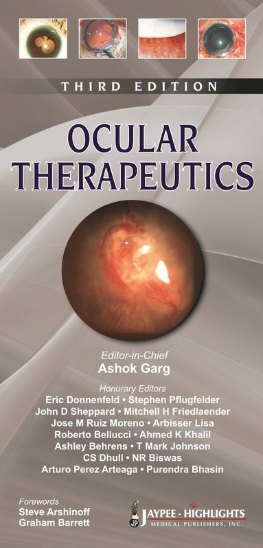 bokomslag Ocular Therapeutics