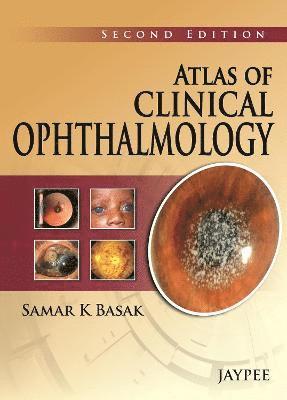 Atlas of Clinical Ophthalmology 1