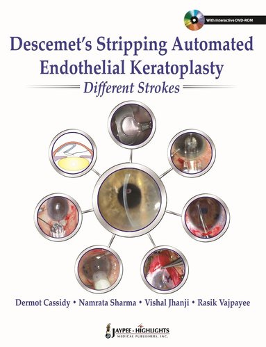 Dermot Cassidy, Namrata Sharma, Vishal Jhanji, Rasik B Vajpayee - Descemet's Stripping Automated Endothelial Keratoplasty: Different Strokes, Inbunden